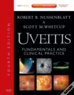 Capa do artigo Uveitis