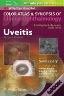 Uveitis
