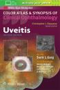 Uveitis - Preview