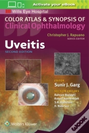 Capa do artigo Uveitis