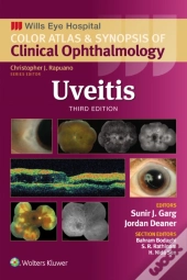 Uveitis
