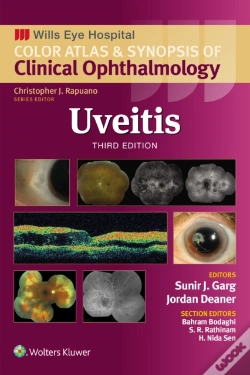 Capa do artigo Uveitis