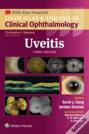 Capa do artigo Uveitis