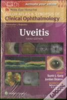 Uveitis