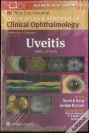 Capa do artigo Uveitis