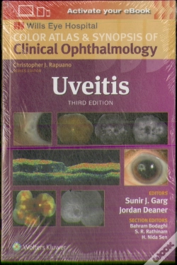 Capa do artigo Uveitis