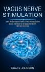 Vagus Nerve Stimulation - Preview
