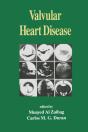 Valvular Heart Disease - Preview