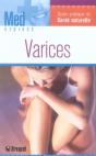 Varices - Preview
