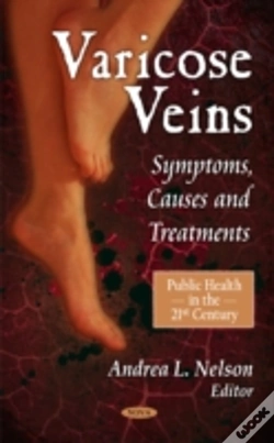Capa do artigo Varicose Veins