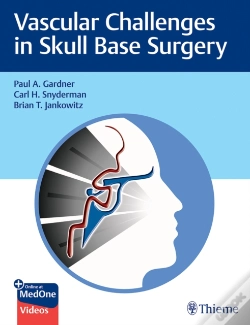 Capa do artigo Vascular Challenges In Skull Base Surgery