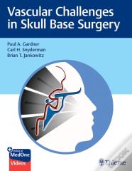 Vascular Challenges In Skull Base Surgery