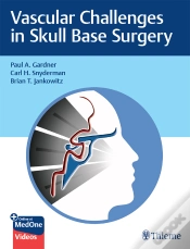 Capa do artigo Vascular Challenges In Skull Base Surgery