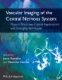 Vascular Imaging Of The Central Nervous System - Preview