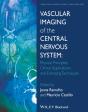 Vascular Imaging Of The Central Nervous System - Preview
