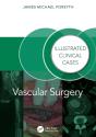 Vascular Surgery: - Preview