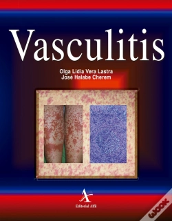 Capa do artigo Vasculitis