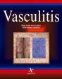 Vasculitis - Preview