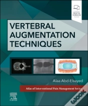 Capa do artigo Vertebral Augmentation Techniques
