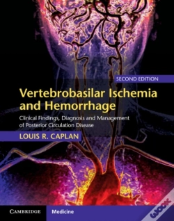 Capa do artigo Vertebrobasilar Ischemia And Hemorrhage