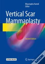 Vertical Scar Mammaplasty