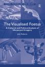 Visualised Foetus - Preview