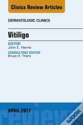 Vitiligo, An Issue Of Dermatologic Clinics