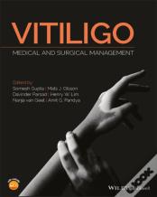 Vitiligo