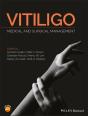 Vitiligo - Preview