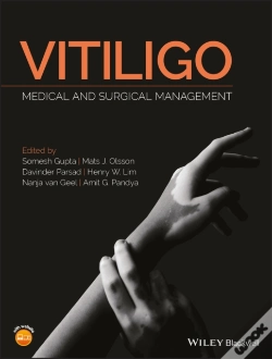 Capa do artigo Vitiligo
