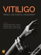 Capa do artigo Vitiligo