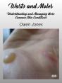 Warts And Moles - Preview