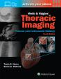 Webb & Higgins Thoracic Imaging: Print + Ebook With Multimedia - Preview