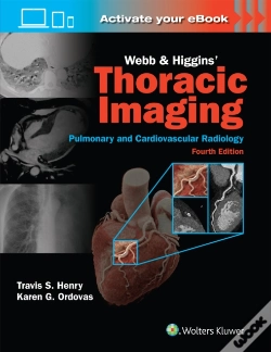 Capa do artigo Webb & Higgins Thoracic Imaging: Print + Ebook With Multimedia