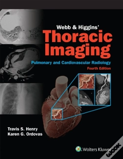 Capa do artigo Webb & Higgins Thoracic Imaging