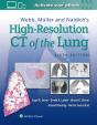 Webb, Muller And Naidich'S High-Resolution Ct Of The Lung - Preview