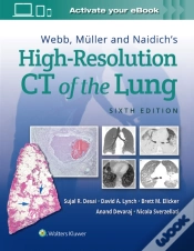 Capa do artigo Webb, Muller And Naidich
