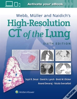 Capa do artigo Webb, Muller And Naidich'S High-Resolution Ct Of The Lung