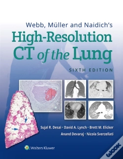 Capa do artigo Webb, Muller And Naidich'S High-Resolution Ct Of The Lung