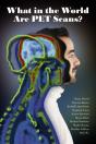 What In The World Are Pet Scans? - Preview