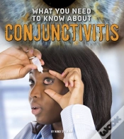 Capa do artigo What You Need To Know About Conjunctivitis