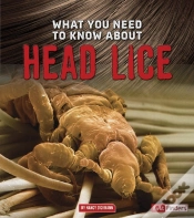 Capa do artigo What You Need To Know About Head Lice