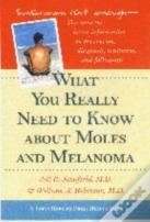 What You Really Need To Know About Moles And Melanoma