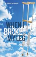 When I Broke My Leg