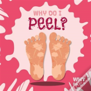 Why Do I Peel?