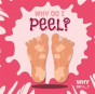 Why Do I Peel? - Preview