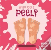 Capa do artigo Why Do I Peel?