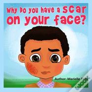 Why Do You Have A Scar On Your Face?