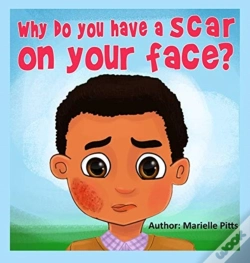 Capa do artigo Why Do You Have A Scar On Your Face?