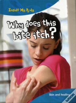Capa do artigo Why Does This Bite Itch?